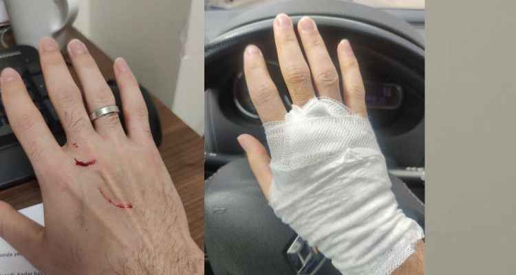 Urfa’da sağlıkçılara şiddet bitmiyor!