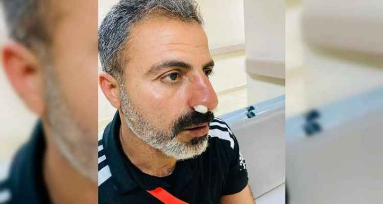 Karaköprü saldırıya uğradı!