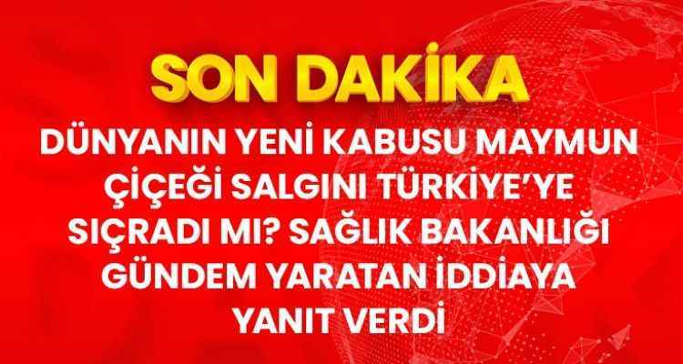 Sağlık Bakanlığı'ndan maymun çiçeği açıklaması: Ülkemizde bugüne kadar herhangi bir vaka görülmemiştir