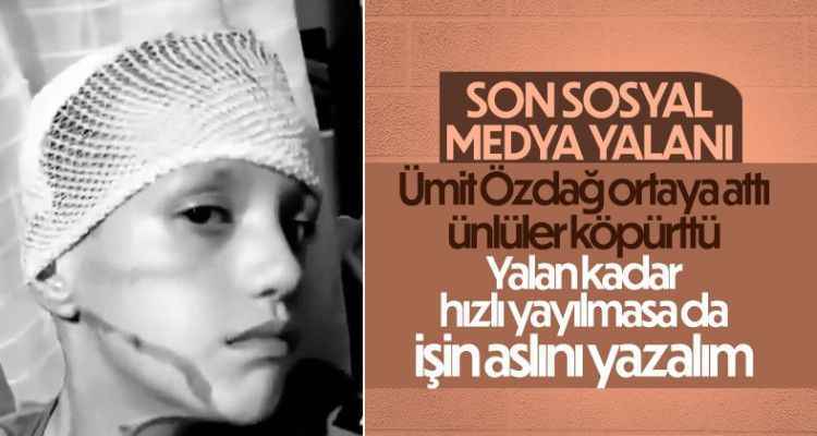 Suriyeliler küçük çocuğa kezzap attı iddiası yalan çıktı