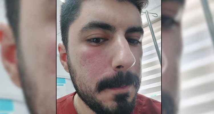 Urfa’da sağlık çalışanına bir şiddet vakası daha!