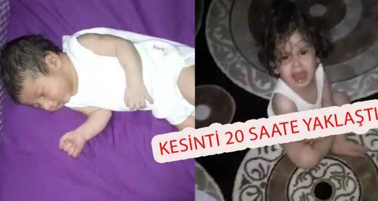 Urfalı bebek gözünü elektrik çilesine açtı! Bir babanın isyanı...
