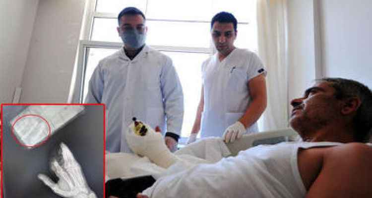 Kopan parmaklarını poşetle hastaneye götürdü, 12 saatte dikildi