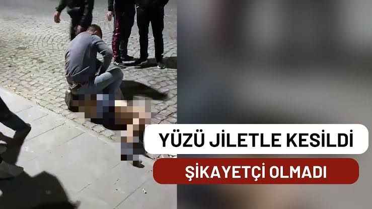 Sokak ortasında dövülüp yüzü jiletle kesildi, Nedeni sonradan ortaya çıktı