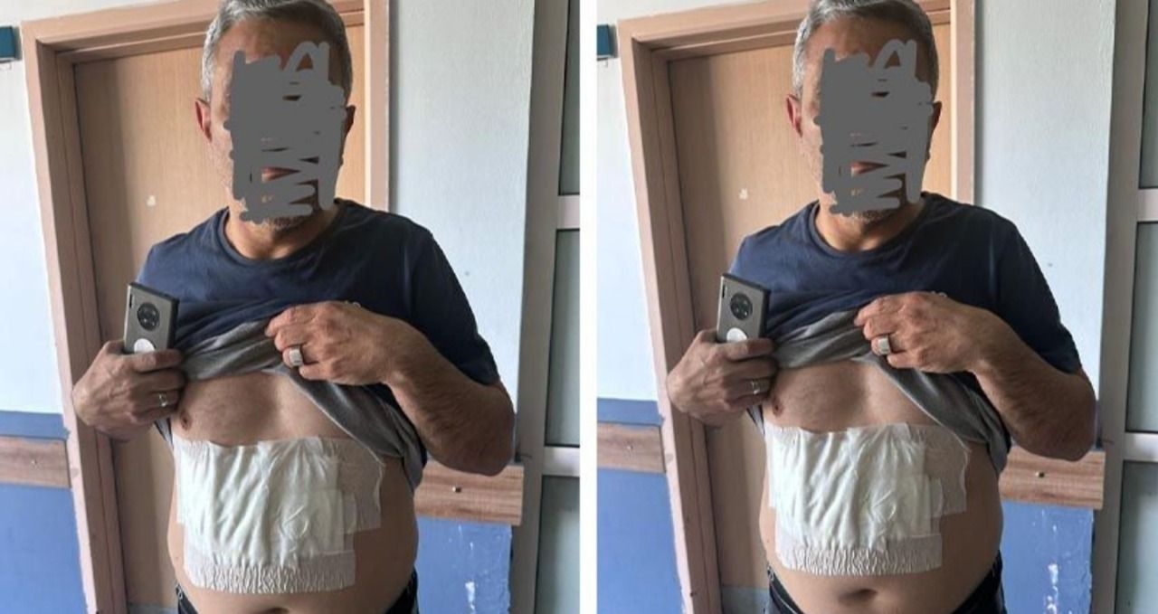 Şanlıurfa'da kaynar su döküldüğü iddiası