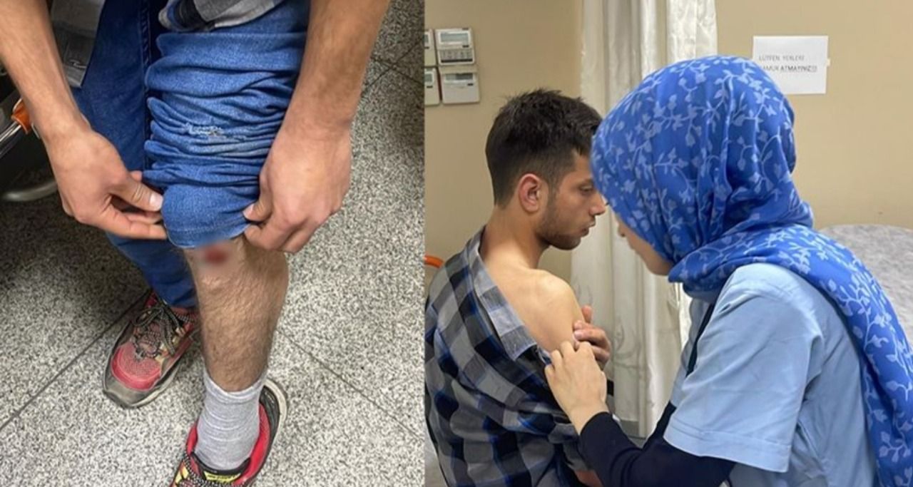 Şanlıurfa’da sokak köpekleri dehşet saçıyor!