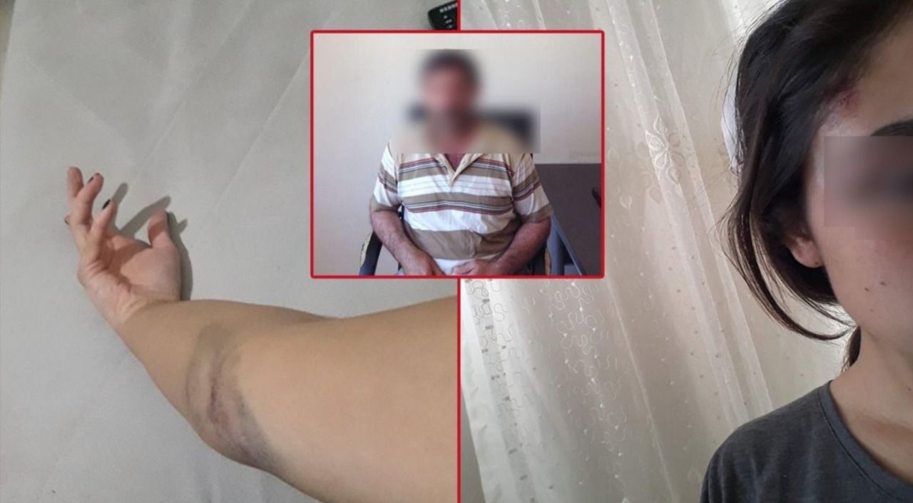 Viranşehirli genç kız şiddet uygulayan babasını ifşa etti