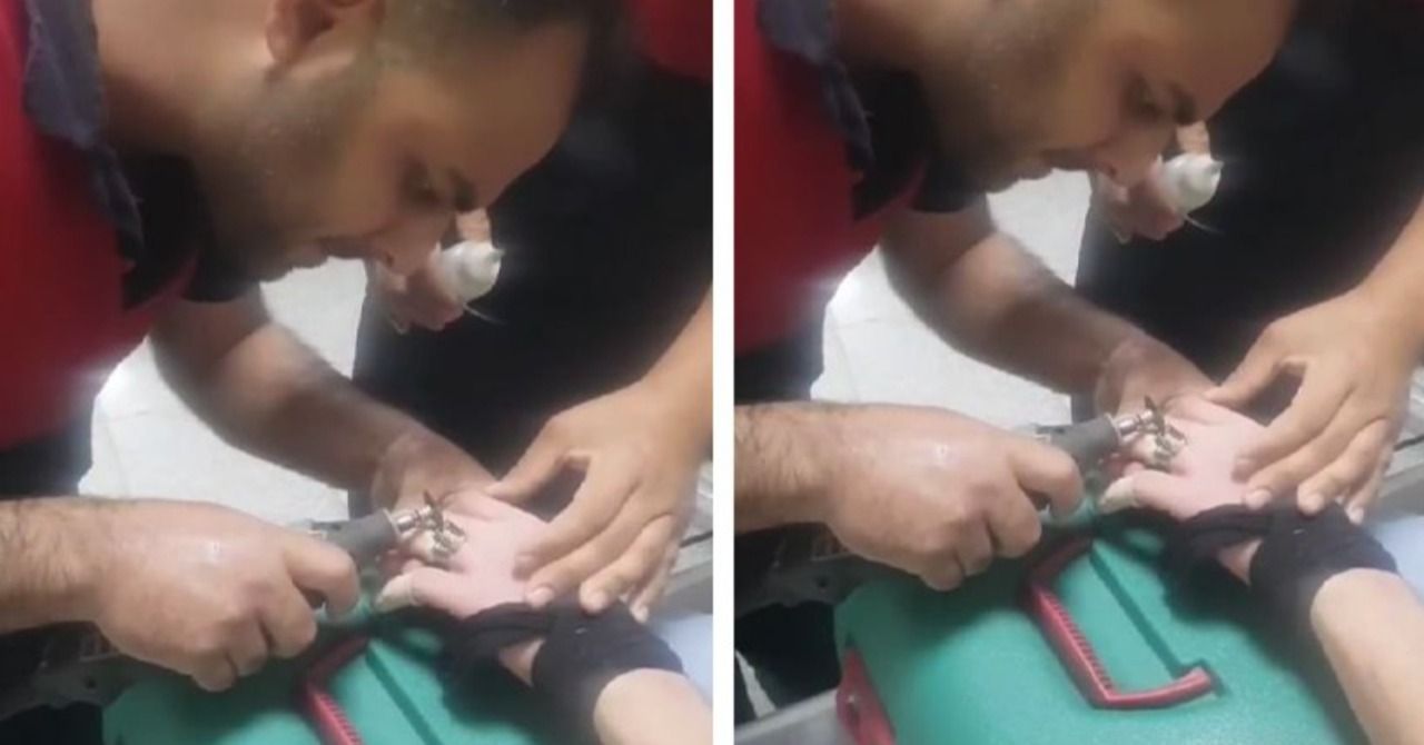 Parmağına yüzük sıkıştı: İmdadına itfaiye yetişti!