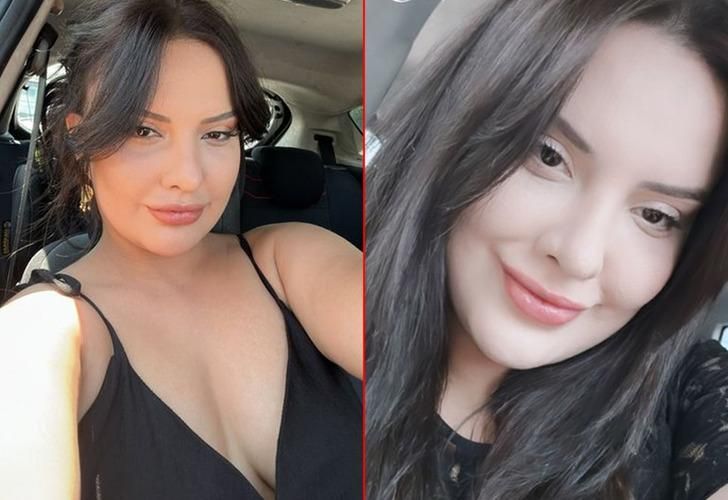 Estetik faciası! Badem göz ameliyatı genç kadının hayatını kararttı! 3 defa ameliyata ikna etti…