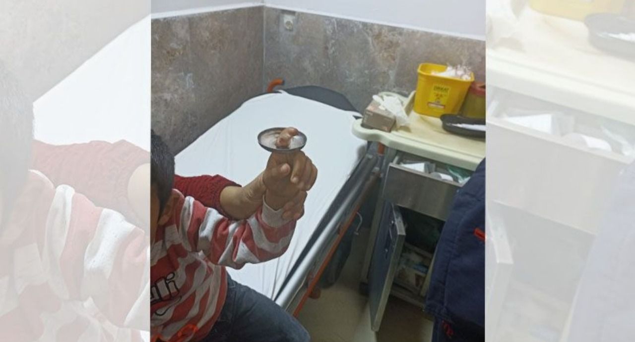 Parmağını öyle bir yere sıkıştırdı ki!