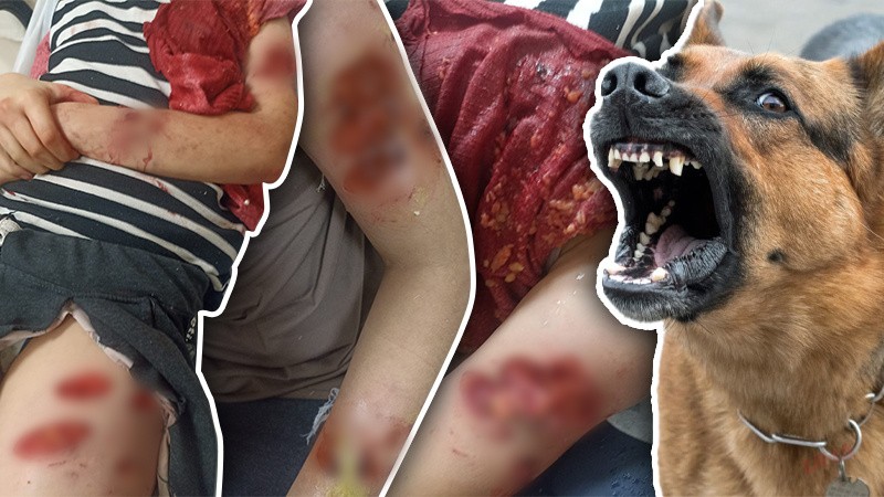 Şanlıurfa'da başıboş köpek dehşeti!